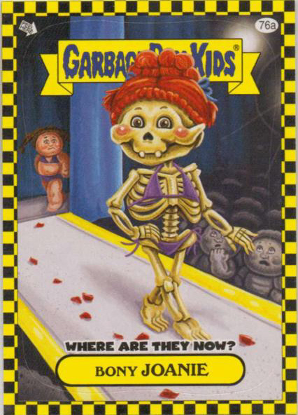 Flashback Card 76a - Bony Joanie Where are They Now